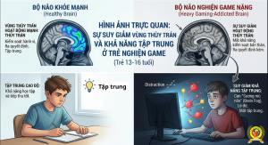 Nghiện game ảnh hưởng nghiêm trọng đến não bộ đến não bộ
