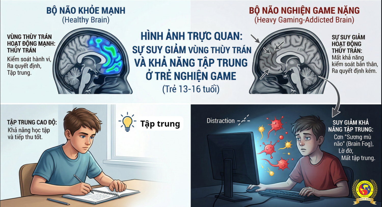 Nghiện game ảnh hưởng nghiêm trọng đến não bộ đến não bộ